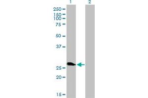 Western Blot analysis of ZNF313 expression in transfected 293T cell line by ZNF313 monoclonal antibody (M01), clone 4G3-1A10.