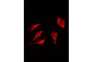 Immunofluorescence (fixed cells) (IF/ICC) image for anti-Nucleophosmin (Nucleolar phosphoprotein B23, Numatrin) (NPM1) (pThr199) antibody (ABIN6256499)