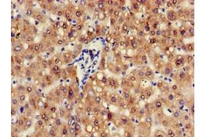 Immunohistochemistry of paraffin-embedded human liver tissue using ABIN7144062 at dilution of 1:100 (ZFAND6 antibody  (AA 1-208))