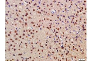 Formalin-fixed and paraffin embedded rat brain labeled with Rabbit Anti-BRD1 Polyclonal Antibody, Unconjugated (ABIN1387435) at 1:200 followed by conjugation to the secondary antibody and DAB staining