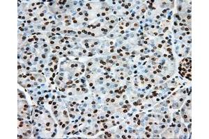 Immunohistochemical staining of paraffin-embedded liver tissue using anti-ERCC1 mouse monoclonal antibody. (ERCC1 antibody)