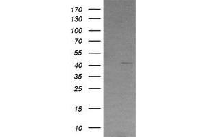 Image no. 1 for anti-Radical S-Adenosyl Methionine Domain Containing 2 (RSAD2) antibody (ABIN1501723) (RSAD2 antibody)