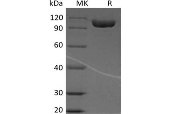 IGSF8 Protein (Fc Tag)