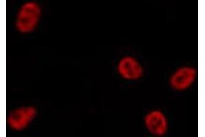 ABIN6269019 staining HepG2 by IF/ICC. (HDAC7 antibody  (C-Term))