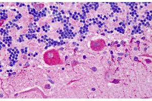 Human Cerebellum: Formalin-Fixed, Paraffin-Embedded (FFPE) (YWHAB antibody  (AA 1-141))
