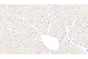 Detection of FGF1 in Caprine Cardiac Muscle Tissue using Polyclonal Antibody to Fibroblast Growth Factor 1, Acidic (FGF1) (FGF1 antibody  (AA 2-155))