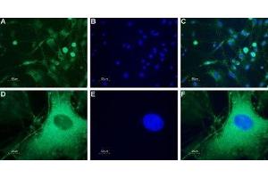 Expression of neuropeptide Y5 receptor in rat DRG - Immunocytochemical staining of a primary culture of rat dorsal root ganglion (DRG) neurons. (NPY5R antibody  (3rd Intracellular Loop))