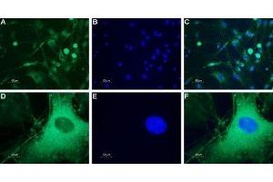 Expression of neuropeptide Y5 receptor in rat DRG - Immunocytochemical staining of a primary culture of rat dorsal root ganglion (DRG) neurons. (NPY5R antibody  (3rd Intracellular Loop))