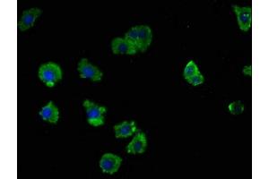 Immunofluorescence staining of HepG2 cells with ABIN7158062 at 1:100, counter-stained with DAPI. (LRTM2 antibody  (AA 36-310))