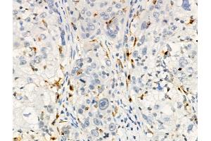 anti-Fanconi Anemia Complementation Group I (FANCI) (pSer559) antibody