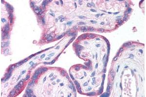 Human Placenta (formalin-fixed, paraffin-embedded) stained with CLIC6 antibody ABIN214747 at 5 ug/ml followed by biotinylated goat anti-rabbit IgG secondary antibody ABIN481713, alkaline phosphatase-streptavidin and chromogen. (CLIC6 antibody  (AA 435-484))