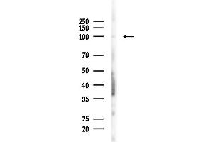 anti-Myb-Like, SWIRM and MPN Domains 1 (MYSM1) (Internal Region) antibody