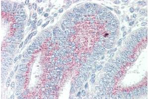 Human Uterus (formalin-fixed, paraffin-embedded) stained with ORAI3 antibody ABIN337113 at 5 ug/ml followed by biotinylated goat anti-rabbit IgG secondary antibody ABIN481713, alkaline phosphatase-streptavidin and chromogen. (ORAI3 antibody  (N-Term))