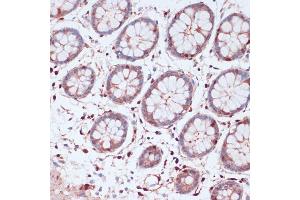 Immunohistochemistry of paraffin-embedded human colon using S100 antibody (ABIN7270126) at dilution of 1:100 (40x lens). (S100A5 antibody  (AA 1-92))