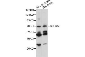 Western blot analysis of extracts of various cell lines, using SLC6A3 antibody (ABIN6291471) at 1:1000 dilution. (SLC6A3 antibody)