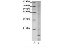 Image no. 1 for anti-Apolipoprotein O (APOO) (N-Term) antibody (ABIN202054) (APOO antibody  (N-Term))