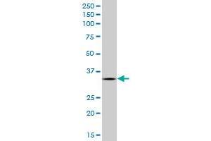 SCYE1 monoclonal antibody (M05), clone 3H5.