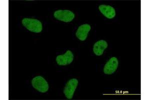 Immunofluorescence (IF) image for anti-DNA Fragmentation Factor, 45kDa, alpha Polypeptide (DFFA) (AA 1-331) antibody (ABIN514953)