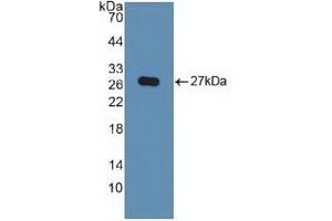 Detection of Recombinant KPNa2, Human using Polyclonal Antibody to Karyopherin Alpha 2 (KPNa2) (KPNA2 antibody  (AA 157-412))