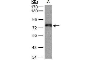 WB Image Sample(30 ug whole cell lysate) A:A431, 7. (ZNF7 antibody)