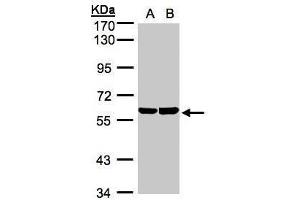 WB Image Sample(30 ug whole cell lysate) A:A431, B:Hep G2 , 7. (TBRG4 antibody)