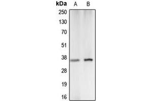 Western blot analysis of Carbonic Anhydrase 5A expression in K562 (A), A549 (B) whole cell lysates. (CA5A antibody  (Center))