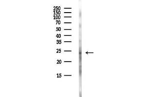 Western blot analysis of lysates from Rat lung, using TP Antibody at 1/1000 dilution.