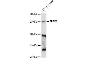 Western blot analysis of extracts of Mouse lung, using SRSF6 antibody (ABIN7270217) at 1:1000 dilution. (SFRS6 antibody  (AA 1-100))