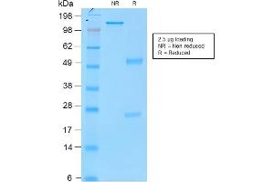 SDS-PAGE Analysis Purified Tyrosinase MouseRecombinantMonoclonal Antibody (rOCA1/812). (Recombinant TYR antibody)