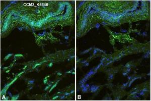 Immunofluorescence staining (green) of Human foreskin (cryo-section of unfixed tissue) with anti-Human CCM2 antibody Cat. (CCM2 antibody  (N-Term))