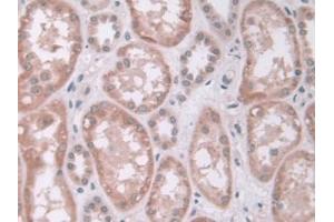 IHC-P analysis of Human Kidney Tissue, with DAB staining. (IDUA antibody  (AA 28-306))