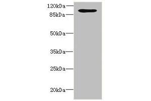 Western blot All lanes: OPHN1 antibody at 1. (Oligophrenin 1 antibody  (AA 1-270))