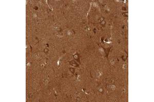 Immunohistochemical staining of human cerebral cortex with CAMSAP2 polyclonal antibody  shows strong cytoplasmic positivity in neurons. (CAMSAP2 antibody)