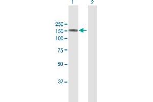 Western Blot analysis of ABL2 expression in transfected 293T cell line by ABL2 MaxPab polyclonal antibody. (ABL2 antibody  (AA 1-1167))