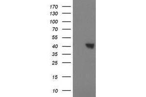 HEK293T cells were transfected with the pCMV6-ENTRY control (Left lane) or pCMV6-ENTRY SULT1C2 (Right lane) cDNA for 48 hrs and lysed. (SULT1C2 antibody)