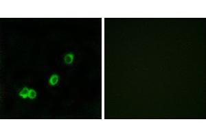 Peptide - +Western blot analysis of extracts from Jurkat cells, using ACOT1 antibody.