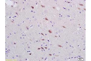 Formalin-fixed and paraffin embedded rat brain labeled with Anti-ADORA1 Polyclonal Antibody, Unconjugated  at 1:200 followed by conjugation to the secondary antibody and DAB staining (ADORA1 antibody  (AA 225-326))