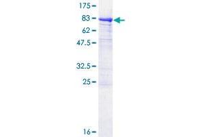 P4HA1 Protein (AA 1-534) (GST tag)