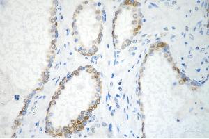 anti-BCL2-Associated Athanogene (BAG1) antibody