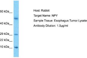 Host: Rabbit Target Name: NPY Sample Type: Esophagus Tumor lysates Antibody Dilution: 1. (NPY antibody  (Middle Region))