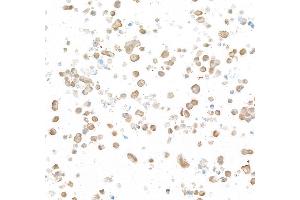 Immunocytochemistry (ICC) image for anti-Ubiquitin Carboxyl-terminal Esterase L1 (Ubiquitin Thiolesterase) (UCHL1) (AA 50-100) antibody (ABIN7449527) (Recombinant UCHL1 antibody  (AA 50-100))