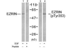 Image no. 1 for anti-Ezrin (EZR) (Tyr353) antibody (ABIN197259) (Ezrin antibody  (Tyr353))