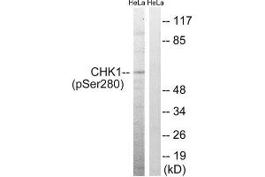 Western Blotting (WB) image for anti-Checkpoint Kinase 1 (CHEK1) (pSer280) antibody (ABIN1847455) (CHEK1 antibody  (pSer280))