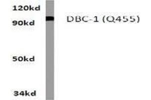 Western blot analysis of KIAA1967 / DBC-1 in A549 whole cell lysate using KIAA1967 antibody .