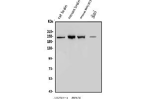 Western blot analysis of non-muscle Myosin IIB/MYH10 using anti-non-muscle Myosin IIB/MYH10 antibody (ABIN7603186).
