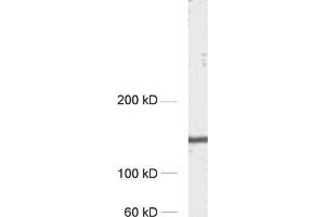 dilution: 1 : 1000, sample: rat hippocampus homogenate (APBA1 antibody  (AA 2-265))
