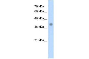 WB Suggested Anti-LOR Antibody Titration:  5. (LOR antibody  (N-Term))