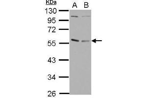 WB Image Sample (30 ug of whole cell lysate) A: Raji B: K562 10% SDS PAGE antibody diluted at 1:1000 (GABPA antibody  (N-Term))