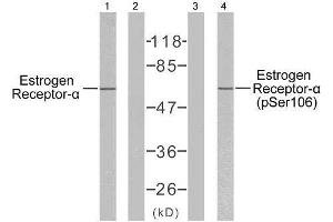 Western blot analysis of extracts from MCF7 cells using Estrogen Receptor-α (Ab-106) antibody (E021066) and Estrogen Receptor-α (phospho-Ser106) antibody (E011071). (Estrogen Receptor alpha antibody)