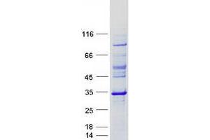 Western Blotting (WB) image for TATA Box Binding Protein Associated Factor 11 (TAF11) protein (Myc-DYKDDDDK Tag) (ABIN2733192)